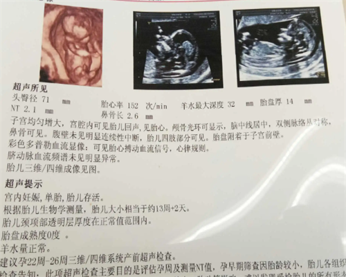 广州助孕包成功包男女，广州有人需要助孕吗？