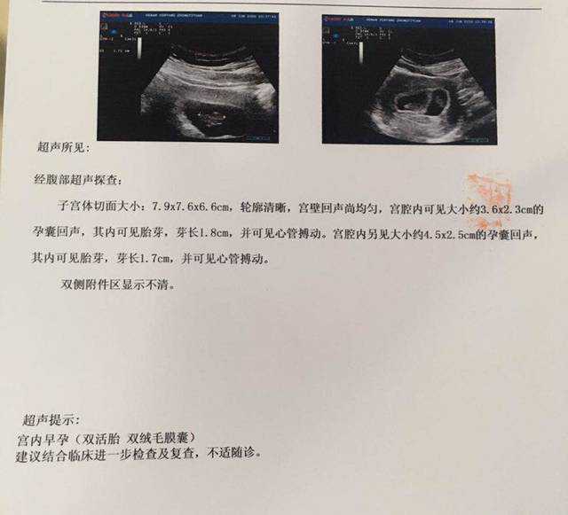广州南方医院可以做供卵试管吗