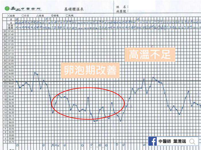 广州可以供卵的公立医院，排卵性不孕的头号病症：多囊性卵巢症候群